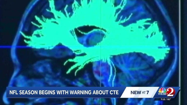 Neurosurgeon And Former Nfl Safety Urges Parents To Prioritize Safety In Youth F