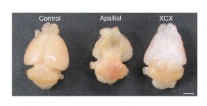 Scientists Create Mice With Human Brain Tissue To Study Autism And Other Disorde