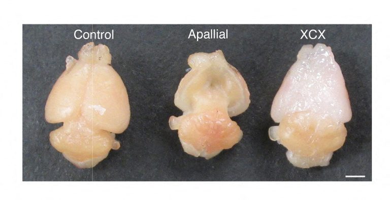 Scientists Create Mice With Human Brain Tissue To Study Autism And Other Disorde