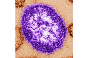 Third Measles Death Reported In Pennsylvania Officials Highlight Risks