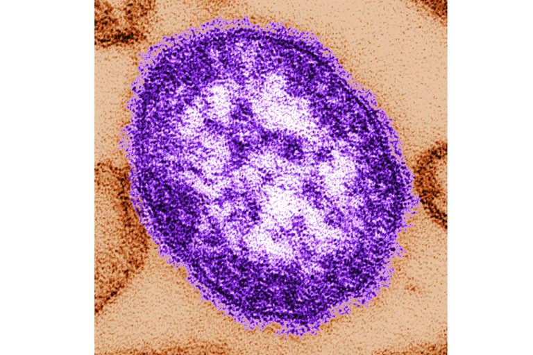 Third Measles Death Reported In Pennsylvania Officials Highlight Risks