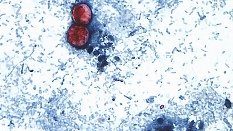 Trump Administration Pushes New Fda Inspection Strategies Amid Cyclospora Lettuc