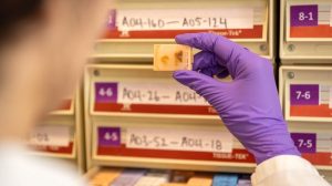 Ucla Procurement Records Show 765 Fee Per Unborn Child Tissue Sample Supplier Wa