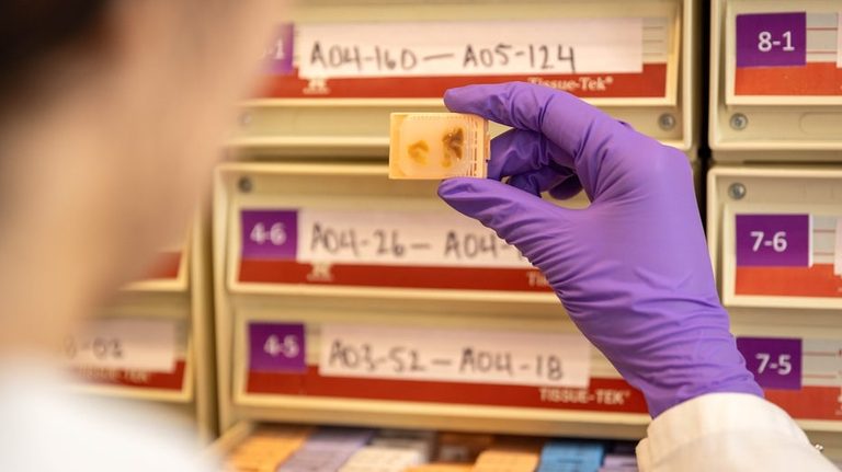 Ucla Procurement Records Show 765 Fee Per Unborn Child Tissue Sample Supplier Wa