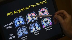 World Alzheimer S Day Highlights Growing Hope As Bill Ritter Shares His Diagnosi