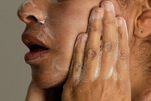 Adult Acne Is Real Expert Tips For Effective Treatment
