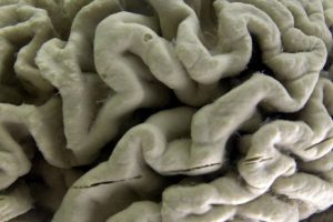 California Voters Face 8 4 Billion Immunology Research Bond On Nov 5