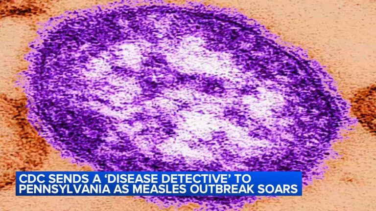 Cdc Deploys Expert To Pennsylvania As Measles Outbreak Claims 6 Lives