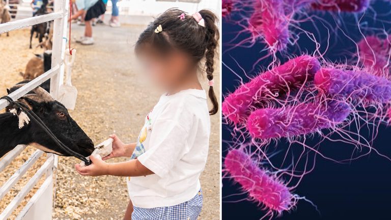 Dallas Health Officials Probe Possible Link Between Child E Coli Cases And State