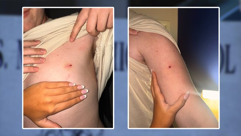 Family Sues Lewisville Isd Over Alleged 2025 Football Hazing Incident