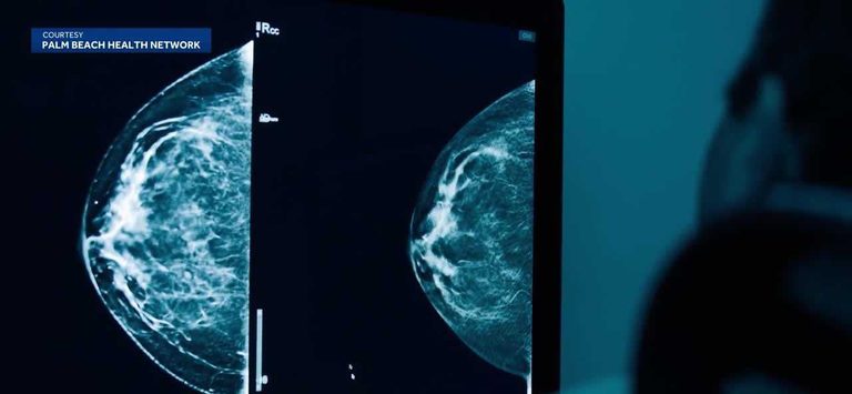 Good Samaritan Medical Center Urges Women To Begin Breast Cancer Screenings At A