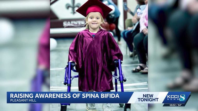 Iowa Family Shares Resilient Journey During Spina Bifida Awareness Month