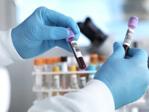 Iowa Governor Candidates Promote New Multi Cancer Blood Test For Residents