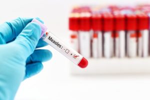 Measles Cases Surge In Pennsylvania And New York While New England Stays Low