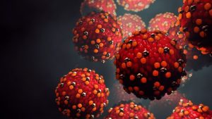 Minnesota Measles Outbreak Hits 80 Cases Most Since 1990