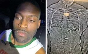 Orlando Jury Convicts Man Who Swallowed Nearly 1 Million In Stolen Tiffany Jewel