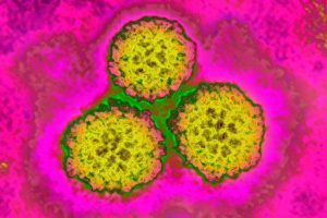 Study Finds 12 Of Global Cancer Cases Linked To Preventable Infections