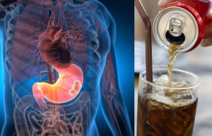 Study Links Daily Sugary Drink Consumption To More Than Double Risk Of Stomach C