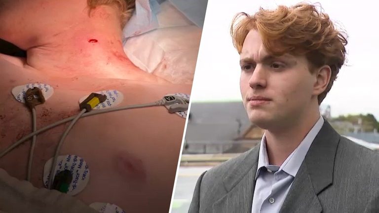 Survivor Of Allston Machete Attack Urges Community Focus On Housing Education An