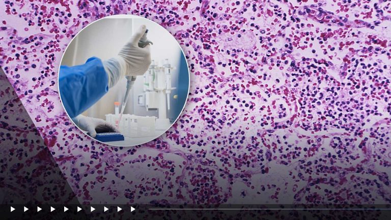U S State Department Keeps Close Watch On Suspected Plague Case In Siberia